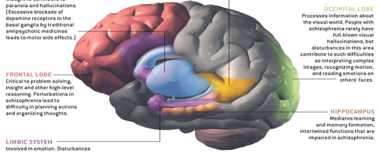 Дослідники виявили нову можливу причину шизофренії