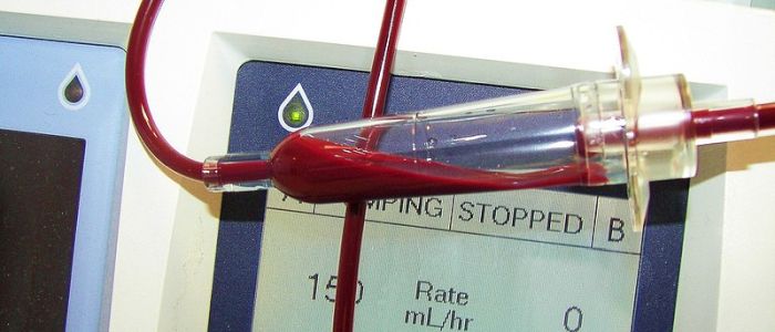 Переливання крові допомогло жінці в менопаузі завагітніти