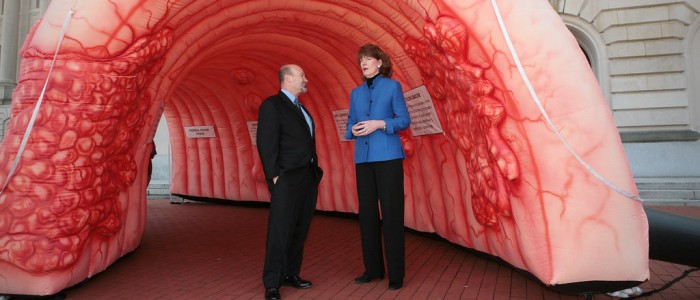 Рак товстої кишки став основною причиною смерті від раку у людей віком до 50 років у США