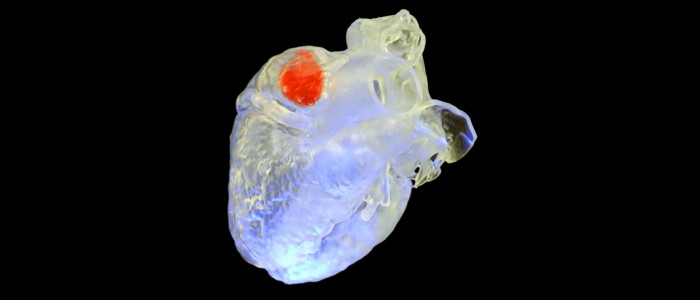 Лікарі винайшли новий спосіб 3D-друку всередині тіла