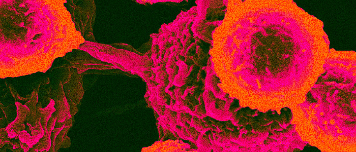 Лікарі кажуть, що вони виявили білок, що зв'язує всі види раку