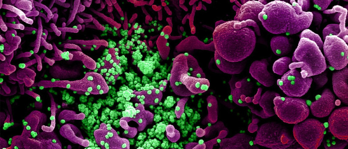 «Вкрай малоймовірно», що коронавірус втік з китайської лабораторії