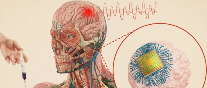 В МТІ винайшли ін'єкційні мозкові чипи