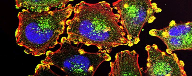 Дослідники знайшли «вбивчий білок», який змушує ракові клітини саморуйнуватися