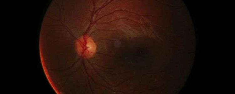 Дослідники, можливо, виявили спосіб вилікувати сліпоту