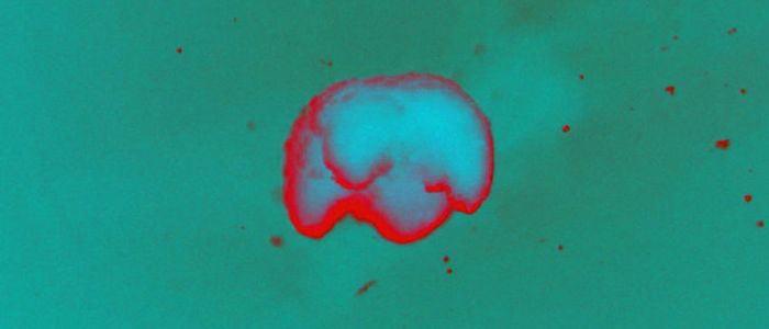 Вчені друкують живих «ксеноботов» з біологічних клітин