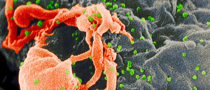 Вчені перетворили ВІЛ на рятівну генну терапію