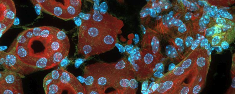 Дослідники використовують стовбурові клітини для зростання функціонуючої нирки