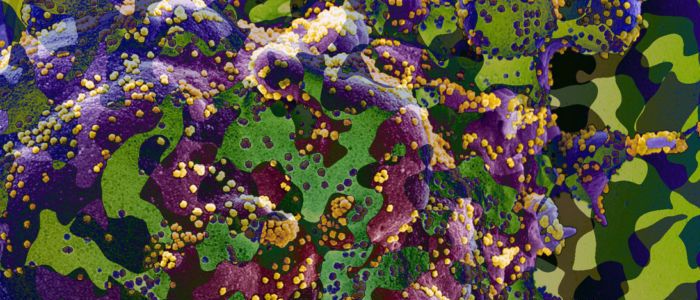 Коронавірус використовує «камуфляжний» ензим, щоб проникнути у ваші клітини