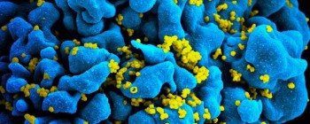Нещодавно виявлені антитіла можуть нейтралізувати 98 відсотків штамів ВІЛ