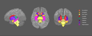 Нове дослідження показує, що мозок людей з депресією виглядає по-різному