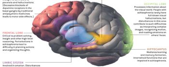 Дослідники виявили нову можливу причину шизофренії