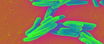 Знайдені нові ліки проти самої смертельної форми туберкульозу