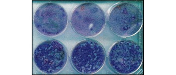 Вакцина проти деменції цілком може вже існувати