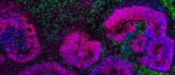 Вчені створили перший в історії атлас розвитку мозку