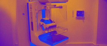 Штучний інтелект від Гугл успішно виявляє рак молочної залози в мамограмах