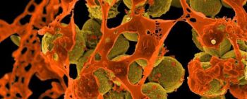 Людські бактерії: ймовірний щит проти раку шкіри