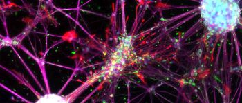 Нейронні стовбурові клітини, вирощені з крові, можуть зробити революцію в медицині