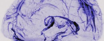 Дослідники відкрили нову систему судин у мозку людини