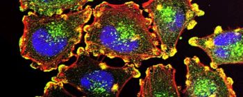 Дослідники знайшли «вбивчий білок», який змушує ракові клітини саморуйнуватися