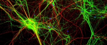 Вчені надрукували живі клітини мозку