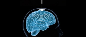 Вчені покращили роботу людського мозку за допомогою імплантатів та штучного інтелекту