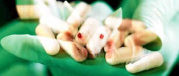 Вчені хакнули мозок миші, щоб «стерти» опіоїдну залежність