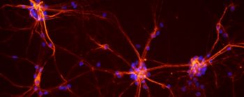 Вчені ідентифікували «клітини тривоги» в мозку, включивши їх і вимкнувши