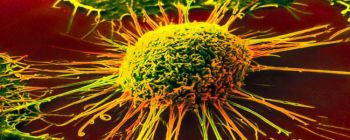 Вчені відкрили каталізатор ракових рецидивів