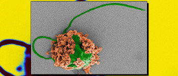 Вчені використовують мікроботів для очищення від пневмонії легенів хворих мишей