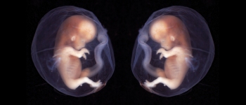 Близнюки народилися з донорських ембріонів, заморожених у 1992 році