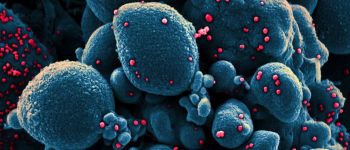 Два дослідження показують, що вологість запобігає поширенню коронавірусу