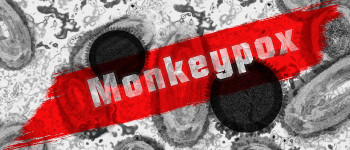 ВООЗ оголосив надзвичайну ситуацію у світі через мавпячу віспу
